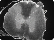 A greyscale cross-section micrograph of a spinal cord, showing the characteristic internal butterfly-shaped gray matter surrounded by white matter tracts.